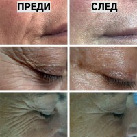 Уред за електропорация